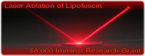 laser ablation of lipofuscin unlimited lifespans research project.png