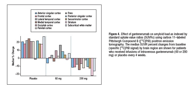  Region-Specific Reduction in Abeta Load