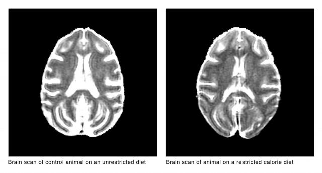 CR Vs. Brain Atrophy in U. Wisconsin Primates