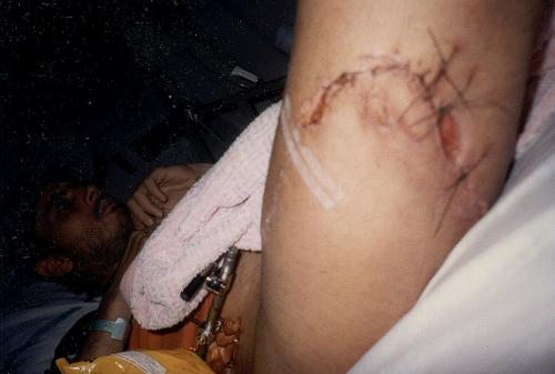 Bike__BLTBYME___002_Accident.jpeg