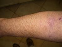 Forearm R Up - 1-8-18.JPG