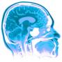 Cerebral Health FDA Inspection (2012) - last post by synapse