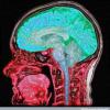 Cadiolipin Antibodies found in Neuro and fatigue pathology - last post by NG_F