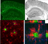 Brain histology - microglia